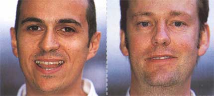 Стефано Сордо и Петер Харрисон